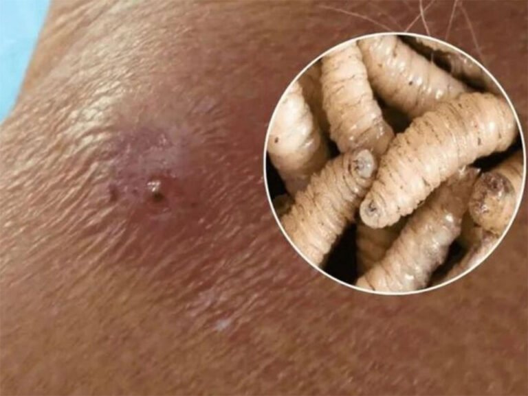 Honduras amplía emergencia sanitaria por el aumento de casos de gusano barrenador 3 Gusano Barrenador del Ganado GBG 1 2