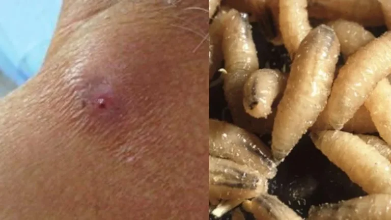 Gusano Barrenador Olancho