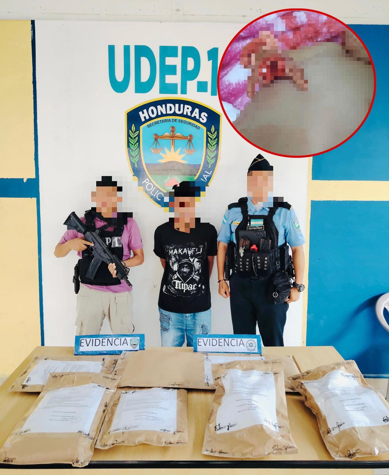 Detienen a sujeto por mutilar dos dedos a su hijo de un año y agredir a su pareja 1 sucesos 2