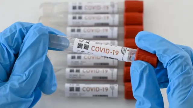 IHSS agota existencias de pruebas rápidas de COVID‑19 en pleno repunte de infecciones 1 111901748 tubo.jpg