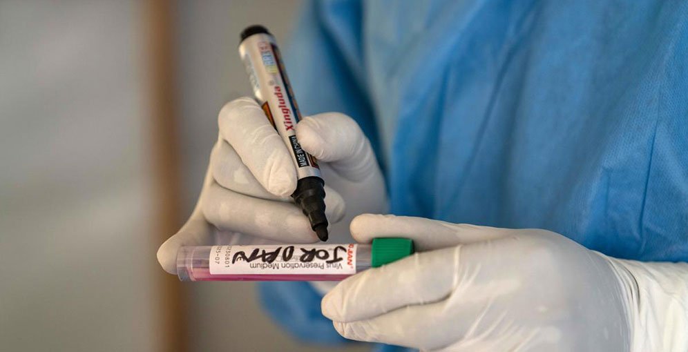 Honduras aplicará cerco epidemiológico tras detectar dos casos de viruela símica en Cortés 1 impondran cerco epidemiologico ante contagios de viruela simica 2