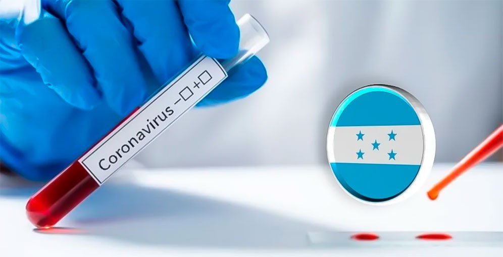 Confirman presencia en Honduras de la variante XFG de COVID-19 1 nueva variante del covid 19 dispara las alarmas en salud