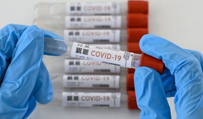 COVID-19 vuelve a aumentar en Hospital Escuela con mayoría de casos en mujeres 1 pruebas covid