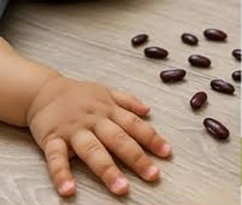 Tragedia en Alubarén: muere niño de un año tras asfixiarse con frijoles crudos 1 mano.jpg