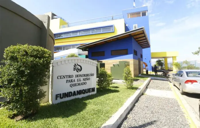 Fundaniquem alerta sobre riesgos de la pólvora tras atender a niño quemado en Intibucá 1 FUNDANIQUEM.jpeg