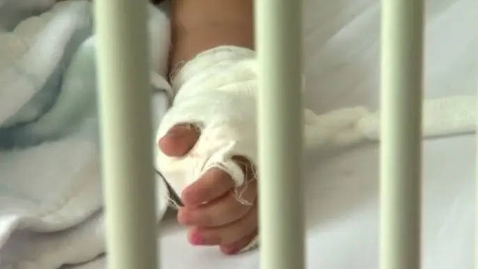 Sube a 16 el número de víctimas por quemaduras de pólvora en San Pedro Sula 1 menor quemado polvora.jpg