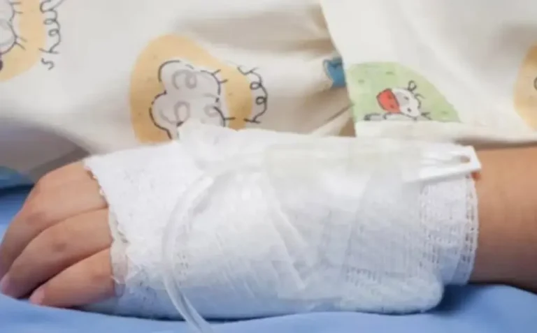 Explosión de cohete deja a niña de 11 años sin una mano en Lempira 2 nina quemada.jpg